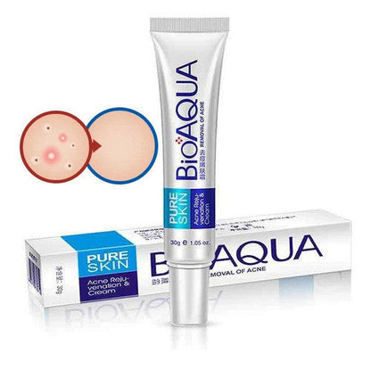 Crema Removedora de Acné 🖐️